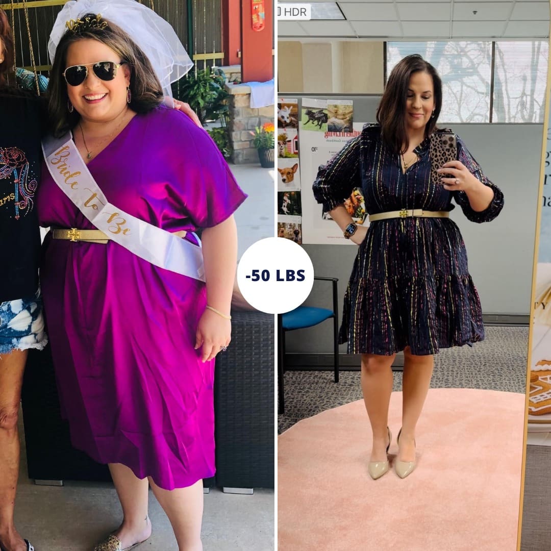 Before and after photo of a patient during the Evaluation Tour at CER Bariatrics.