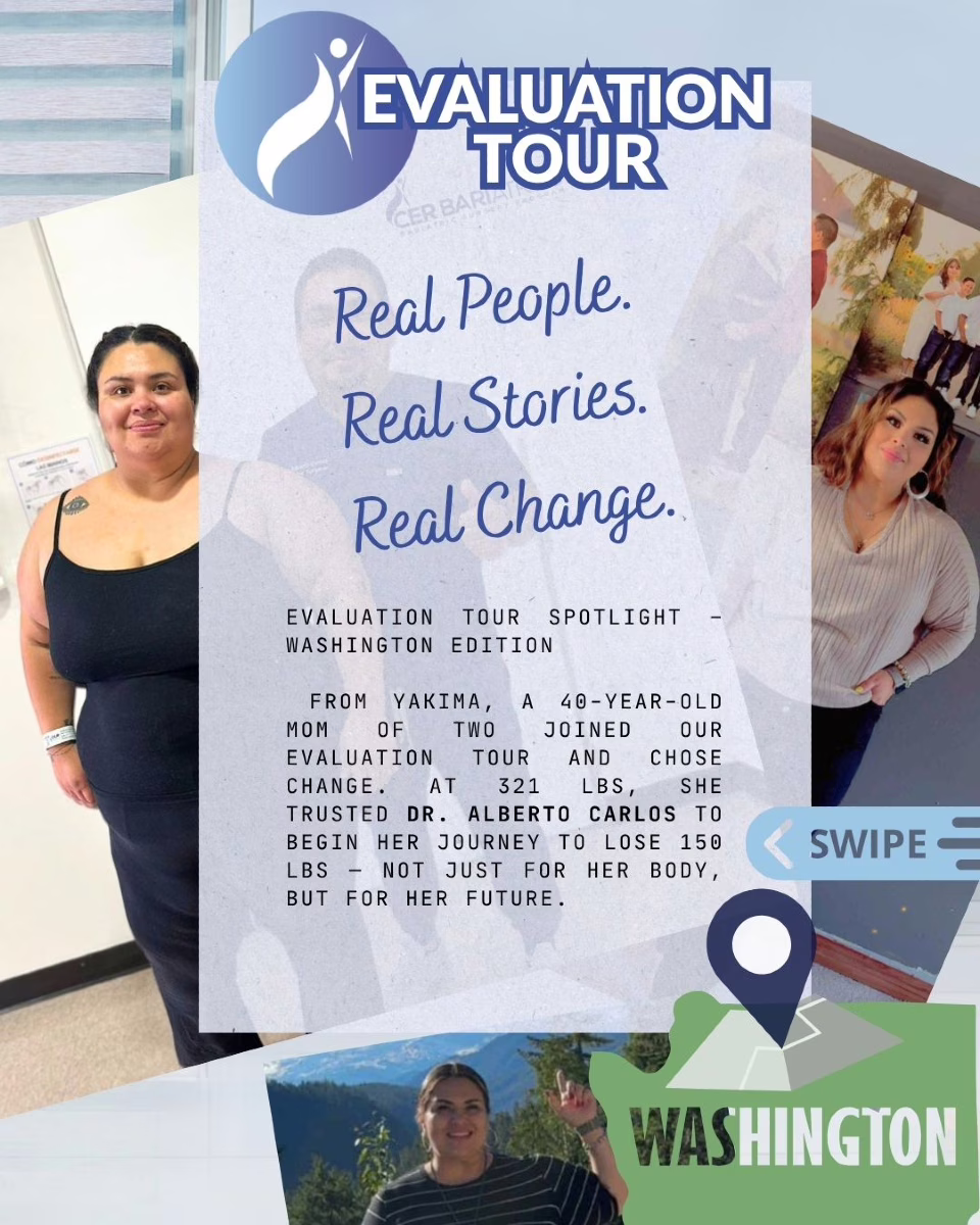 Gastric Sleeve before and after results - CER Bariatrics Tijuana