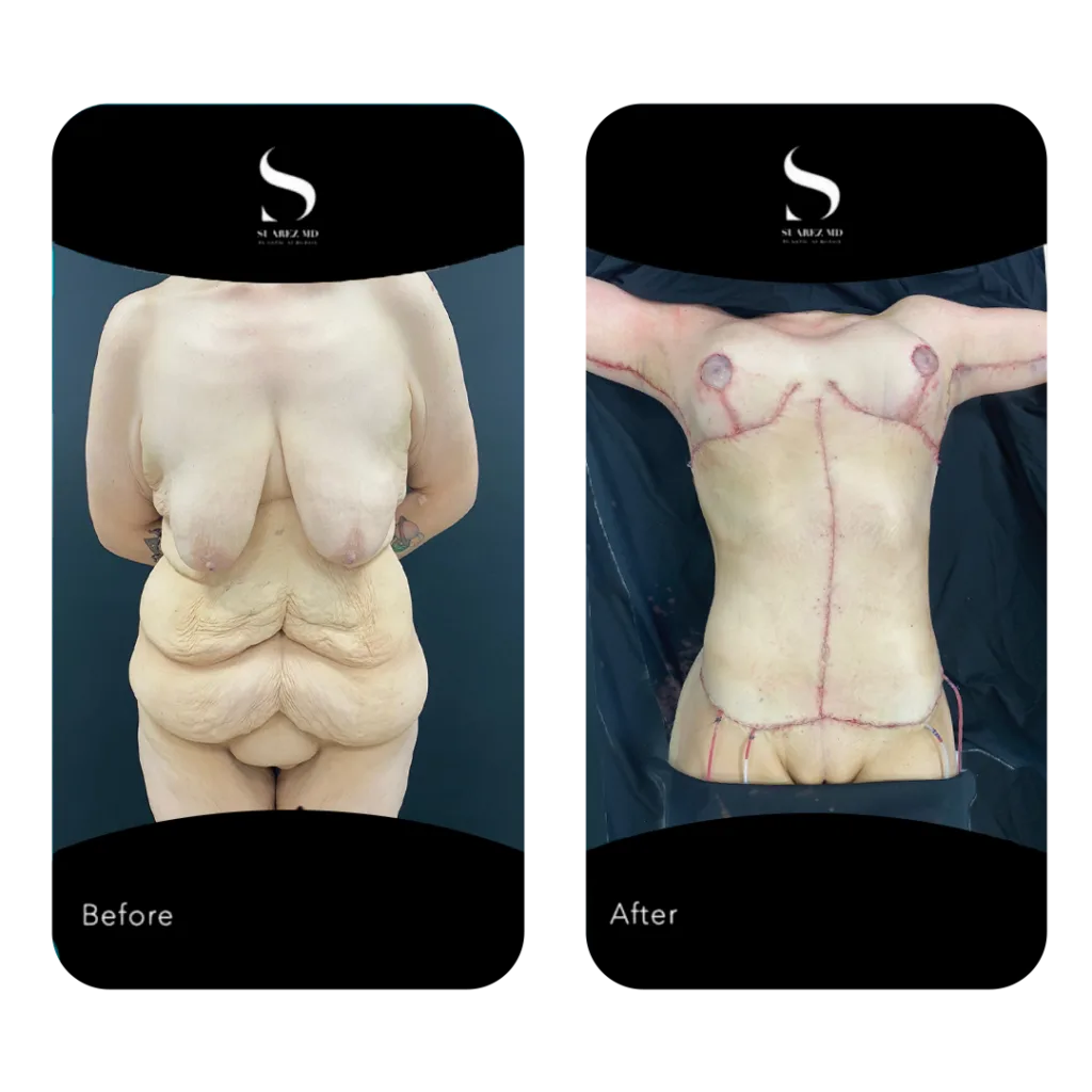 Before/After 4